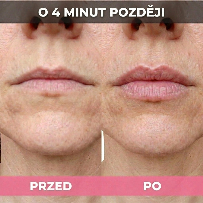 Slider Image 6
