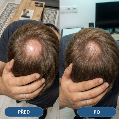 3+3 Zdarma USA Hair Elixir Pro Muže – extrémně účinně nastartuje růst vlasů a zastaví vypadávání vlasů
