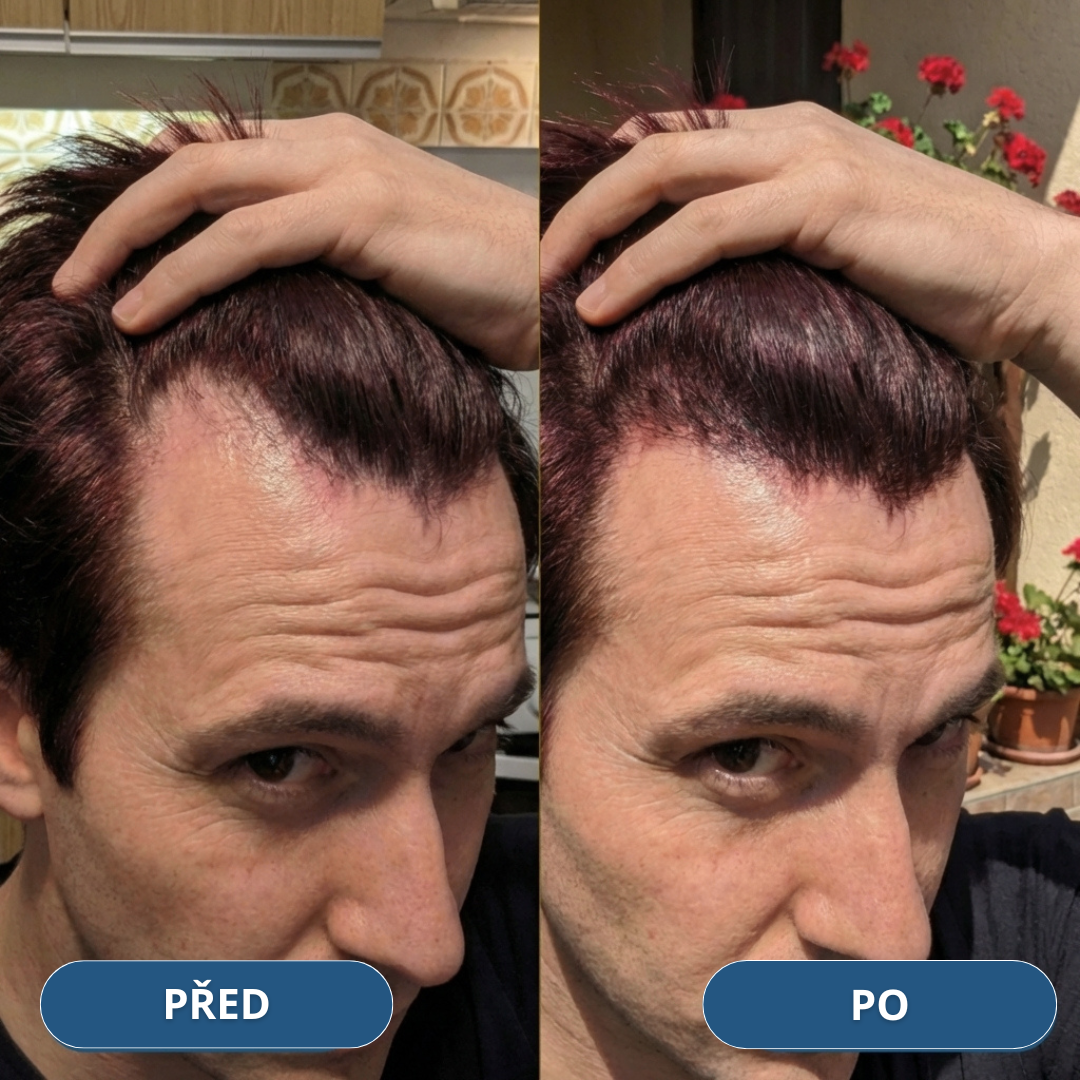 3+3 Zdarma USA Hair Elixir Pro Muže – extrémně účinně nastartuje růst vlasů a zastaví vypadávání vlasů
