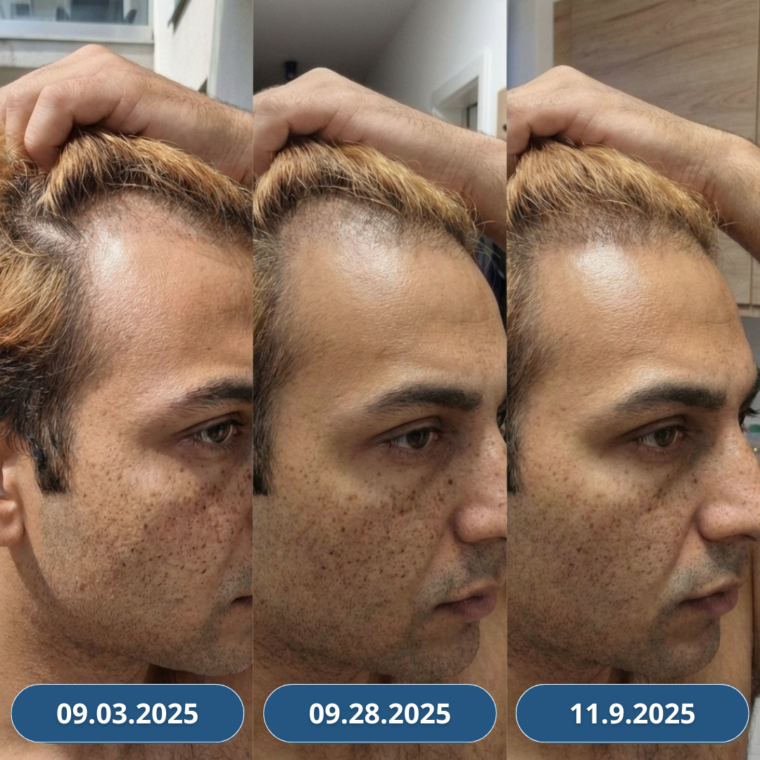 3+3 Zdarma USA Hair Elixir Pro Muže – extrémně účinně nastartuje růst vlasů a zastaví vypadávání vlasů