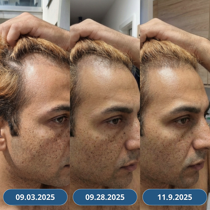 3+3 Zdarma USA Hair Elixir Pro Muže – extrémně účinně nastartuje růst vlasů a zastaví vypadávání vlasů