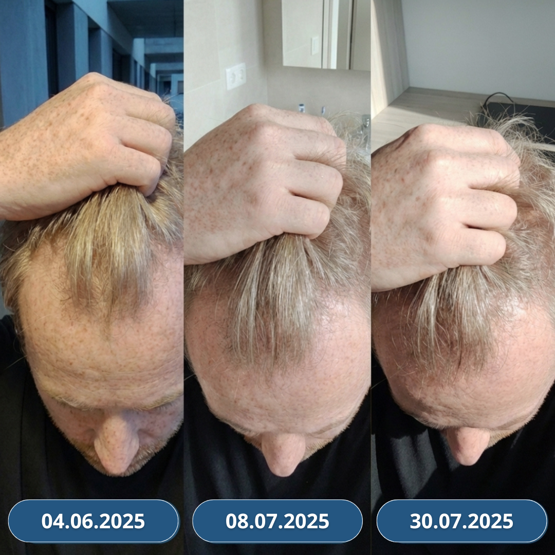 3+3 Zdarma USA Hair Elixir Pro Muže – extrémně účinně nastartuje růst vlasů a zastaví vypadávání vlasů