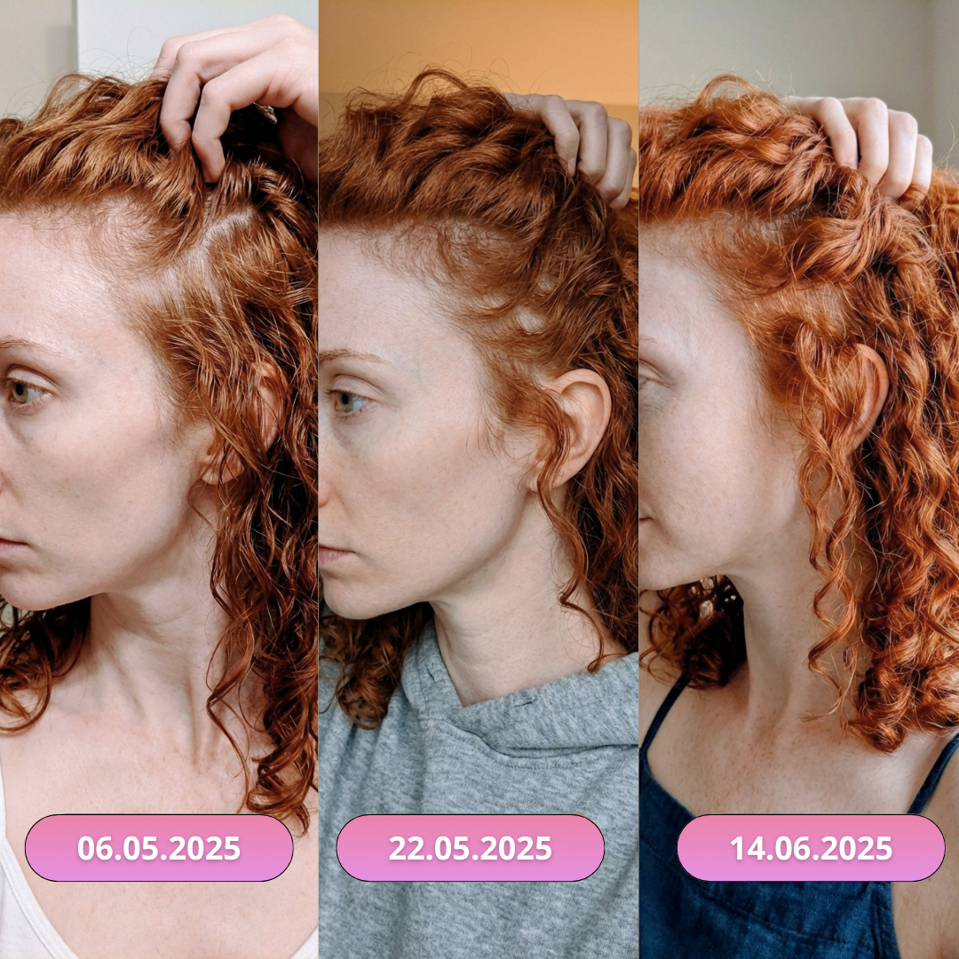 Left Image