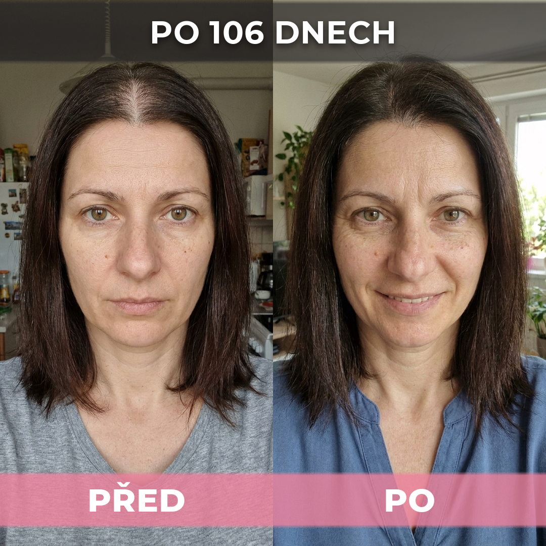 2 ks USA Hair Elixir pro ženy – extrémně účinně nastartuje růst vlasů a zastaví vypadávání vlasů