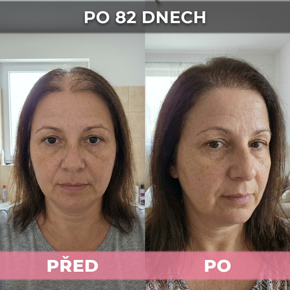 2 ks USA Hair Elixir pro ženy – extrémně účinně nastartuje růst vlasů a zastaví vypadávání vlasů