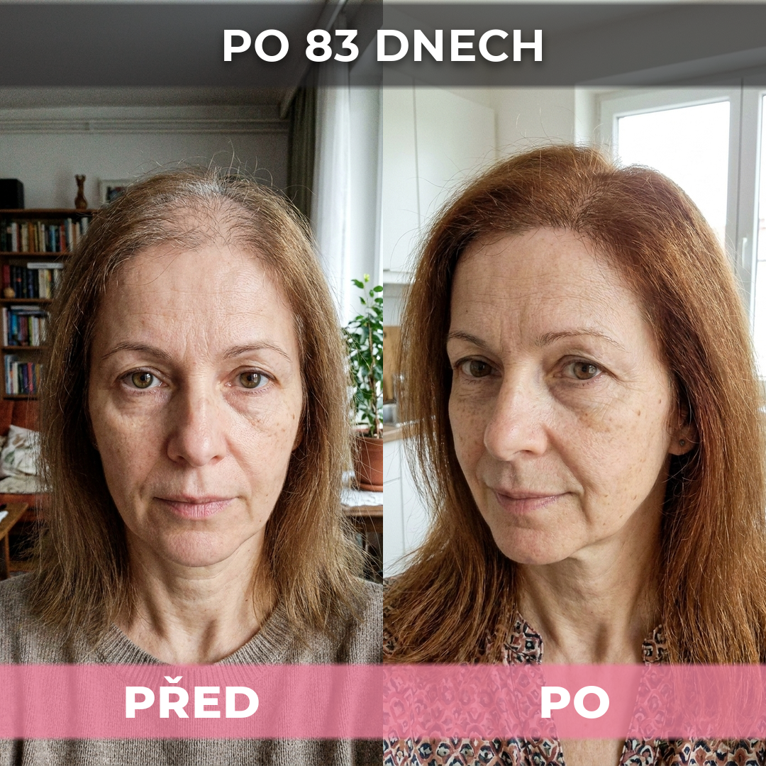 2 ks USA Hair Elixir pro ženy – extrémně účinně nastartuje růst vlasů a zastaví vypadávání vlasů
