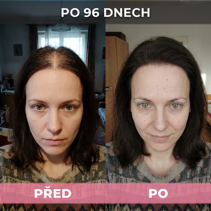 2 ks USA Hair Elixir pro ženy – extrémně účinně nastartuje růst vlasů a zastaví vypadávání vlasů